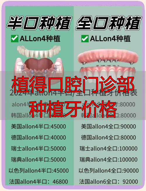 种植牙成功率_种植牙费用_植得口腔门诊部种植牙价格