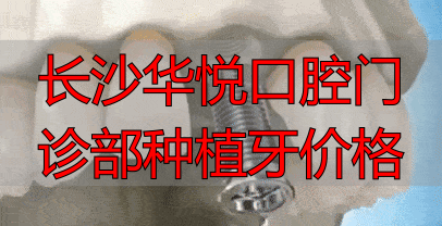 长沙美奥口腔医院种植牙