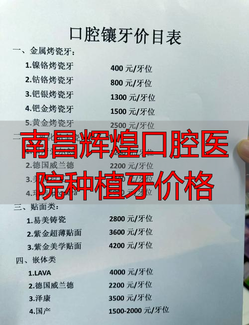 南昌种植牙医院排名_南昌辉煌口腔医院种植牙价格_南昌种植牙好的牙科