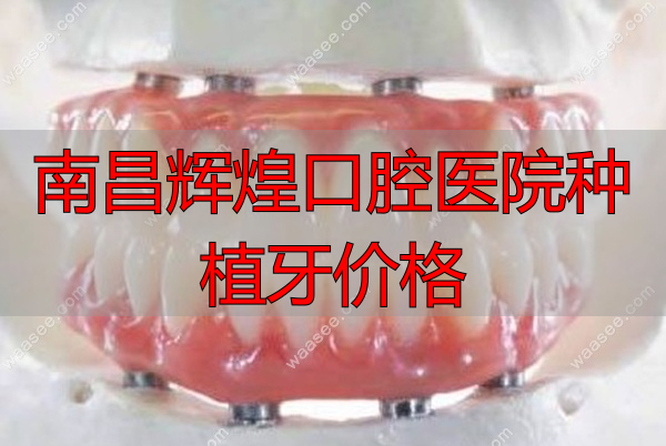 全口种植牙图www.waasee.com