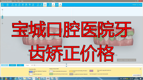 共青城雅美口腔牙齿正畸对比