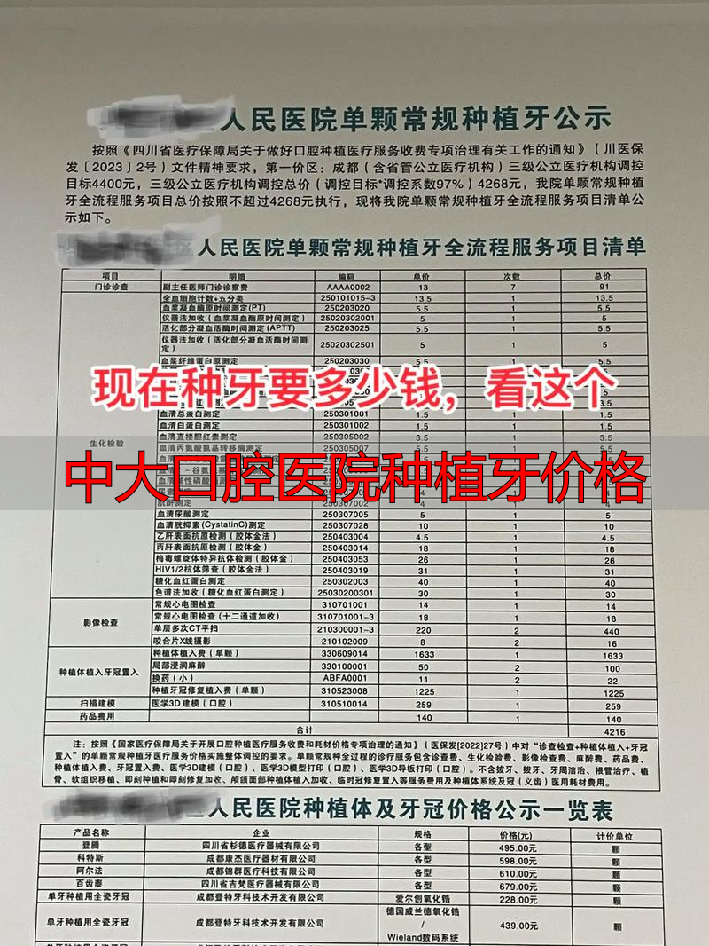 种植大牙多少钱一颗2020_中大口腔医院种植牙价格_口腔中大牙种植医院价格贵吗