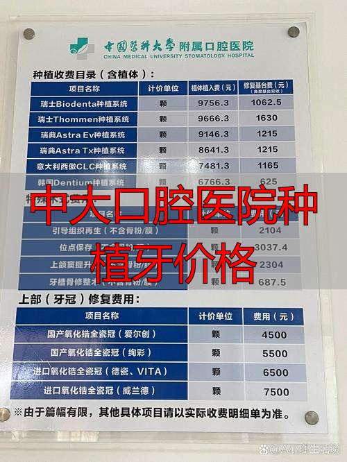 种植大牙多少钱一颗2020_口腔中大牙种植医院价格贵吗_中大口腔医院种植牙价格