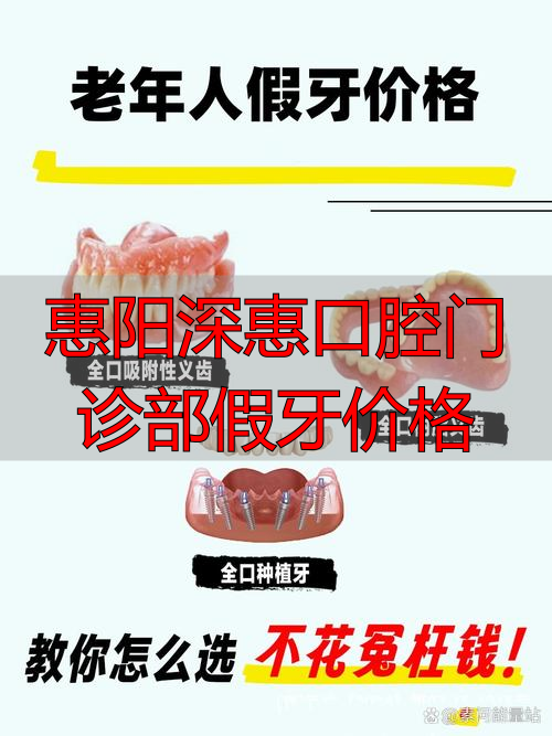 惠州假牙厂_惠阳深惠口腔门诊部假牙价格_惠阳牙科诊所