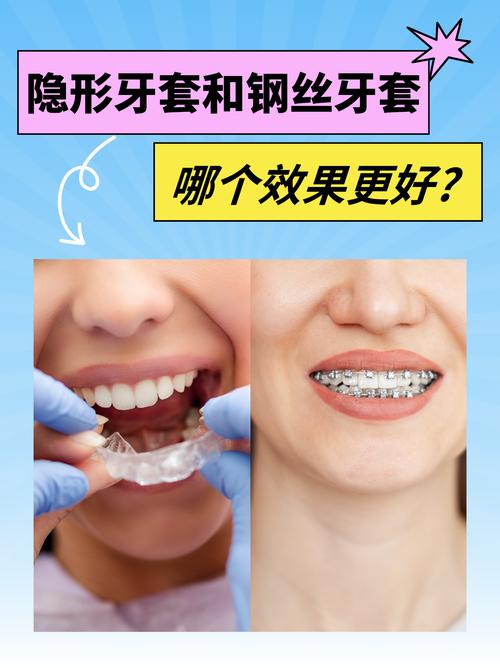 怡美口腔诊所口碑如何？有好有坏，隐形矫正较受认可