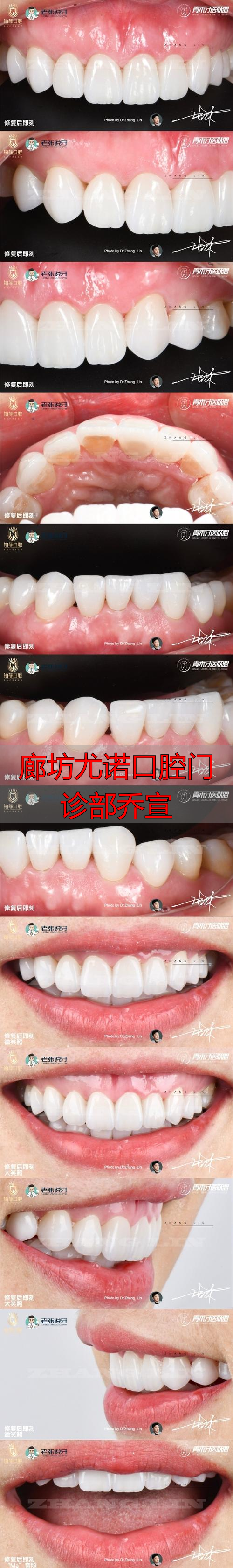 2025年12月廊坊口碑推荐！乔宣医生数字化种植与美学修复深度评价，哪个好？