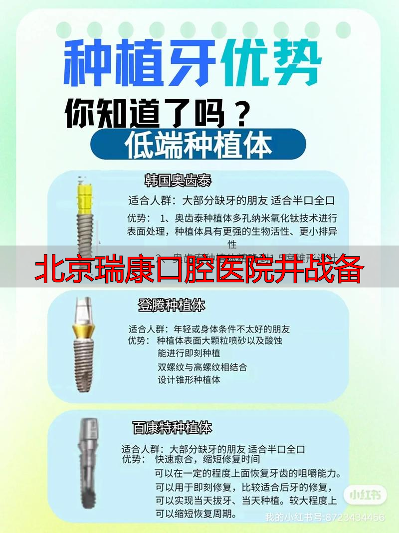2025年末深度评价：北京瑞康口腔井战备医生种植牙，哪个品牌能挺几十年？
