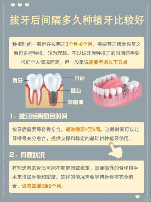 在致力宝口腔做种植牙疼不疼？要多久？听听过来人的真实经历