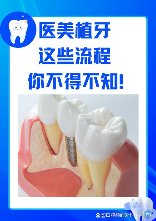 东莞华美口腔美容中心种植牙怎么样_华美齿科种植牙_华美种植牙价格