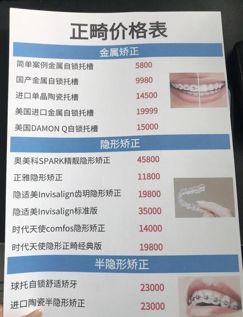 和乐口腔门诊部牙齿矫正价格_口腔医院牙齿矫正_口腔医院矫正