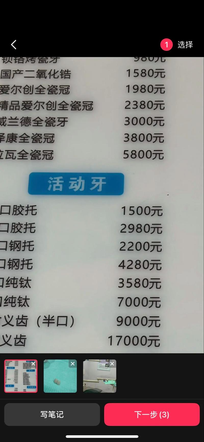 苏州美奥口腔(昆山店）假牙价格_苏州口腔医院假牙价格表_苏州假牙厂