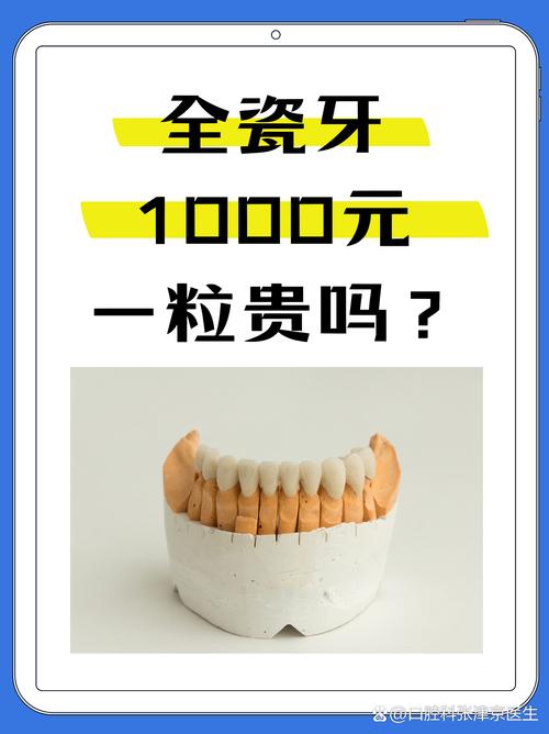 苏州假牙厂_苏州口腔医院假牙价格表_苏州美奥口腔(昆山店）假牙价格