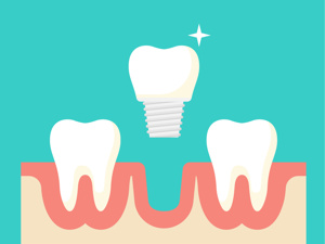 热搜速览！武汉种植牙医院收费正规吗：全口种植牙的价格一般多少钱