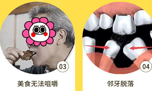 牙齿脱落无法咀嚼影响健康