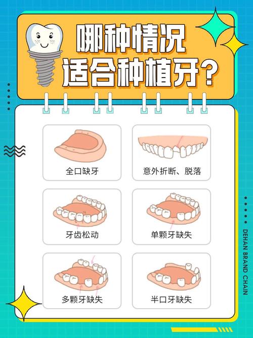 吴君让医生种植技术_东莞南城优梨口腔门诊部_东莞南城众芽口腔种植牙