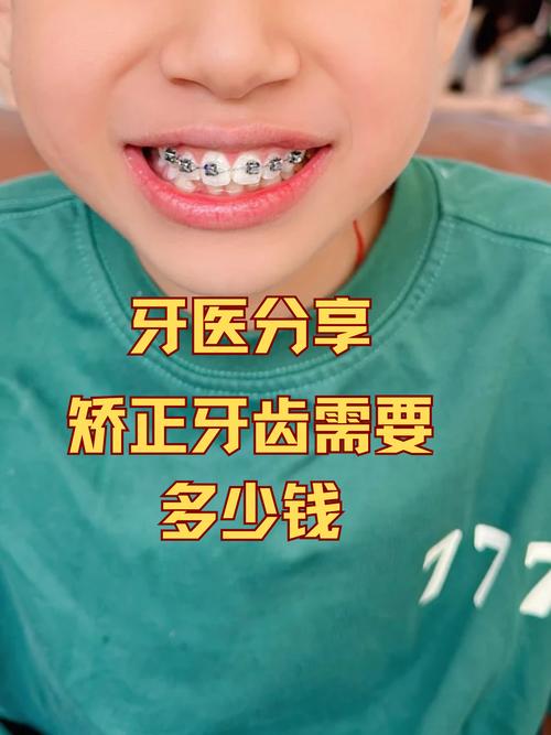 武冈汪大夫口腔医院牙齿矫正_武冈汪大夫口腔医院怎么样_武冈汪大夫口腔医院