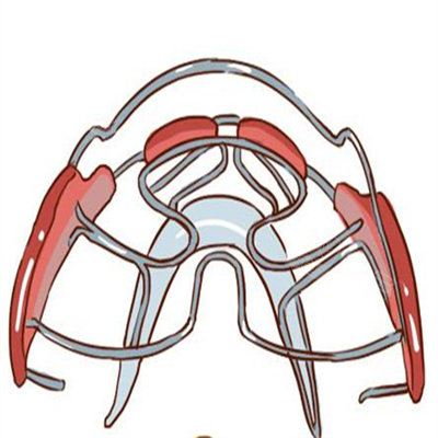 牙齿矫正卡通图
