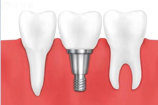 宜春康贝口腔医院上班时间表查询，地址、营业时间、实力与收费价格表全知道